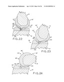 ANTERIOR CRUCIATE LIGAMENT SUBSTITUTING KNEE IMPLANTS diagram and image