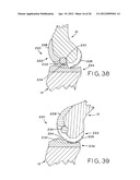 ANTERIOR CRUCIATE LIGAMENT SUBSTITUTING KNEE IMPLANTS diagram and image