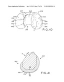 ANTERIOR CRUCIATE LIGAMENT SUBSTITUTING KNEE IMPLANTS diagram and image