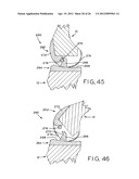 ANTERIOR CRUCIATE LIGAMENT SUBSTITUTING KNEE IMPLANTS diagram and image