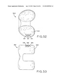 ANTERIOR CRUCIATE LIGAMENT SUBSTITUTING KNEE IMPLANTS diagram and image