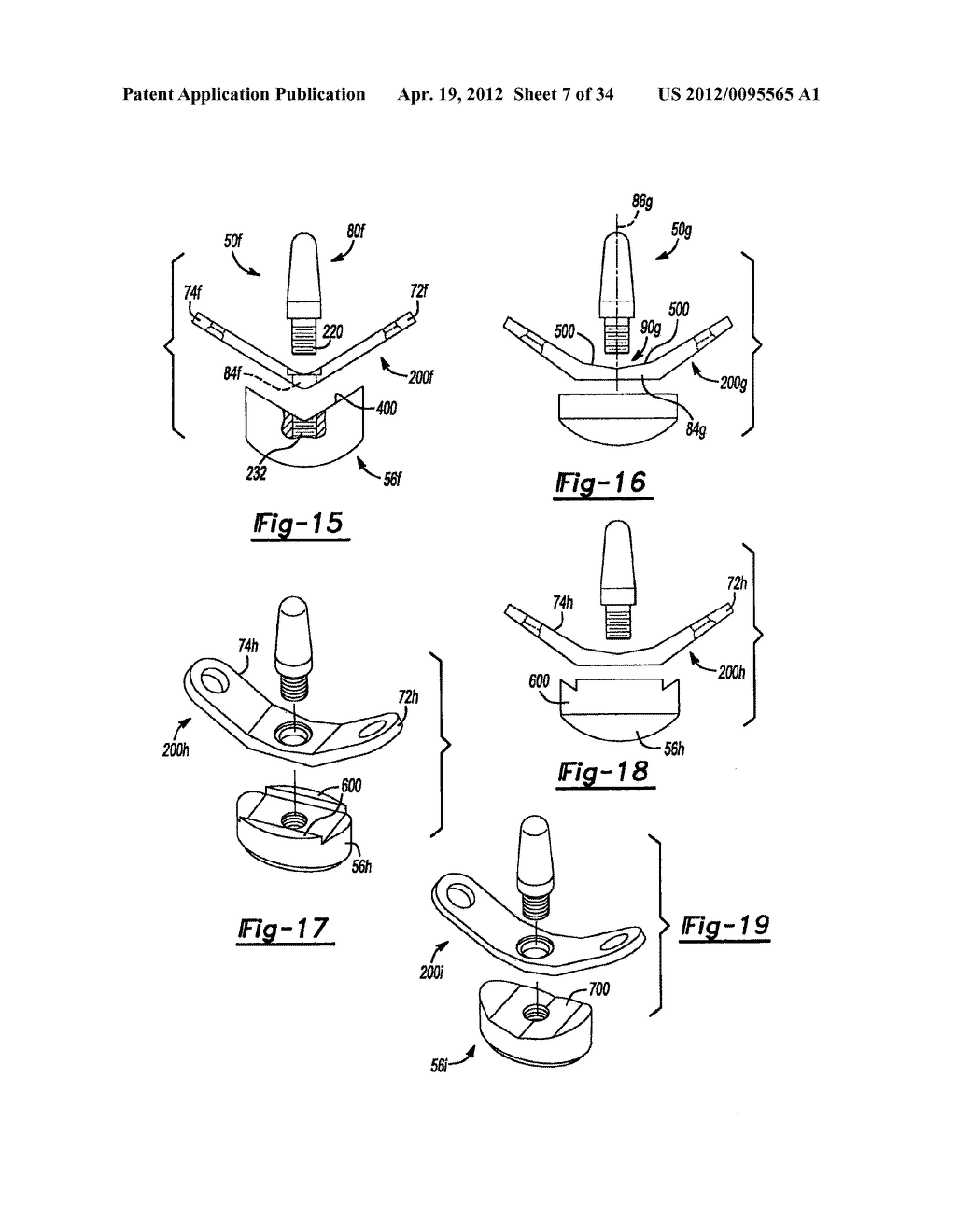 Method And Apparatus For Wrist Arthroplasty - diagram, schematic, and image 08