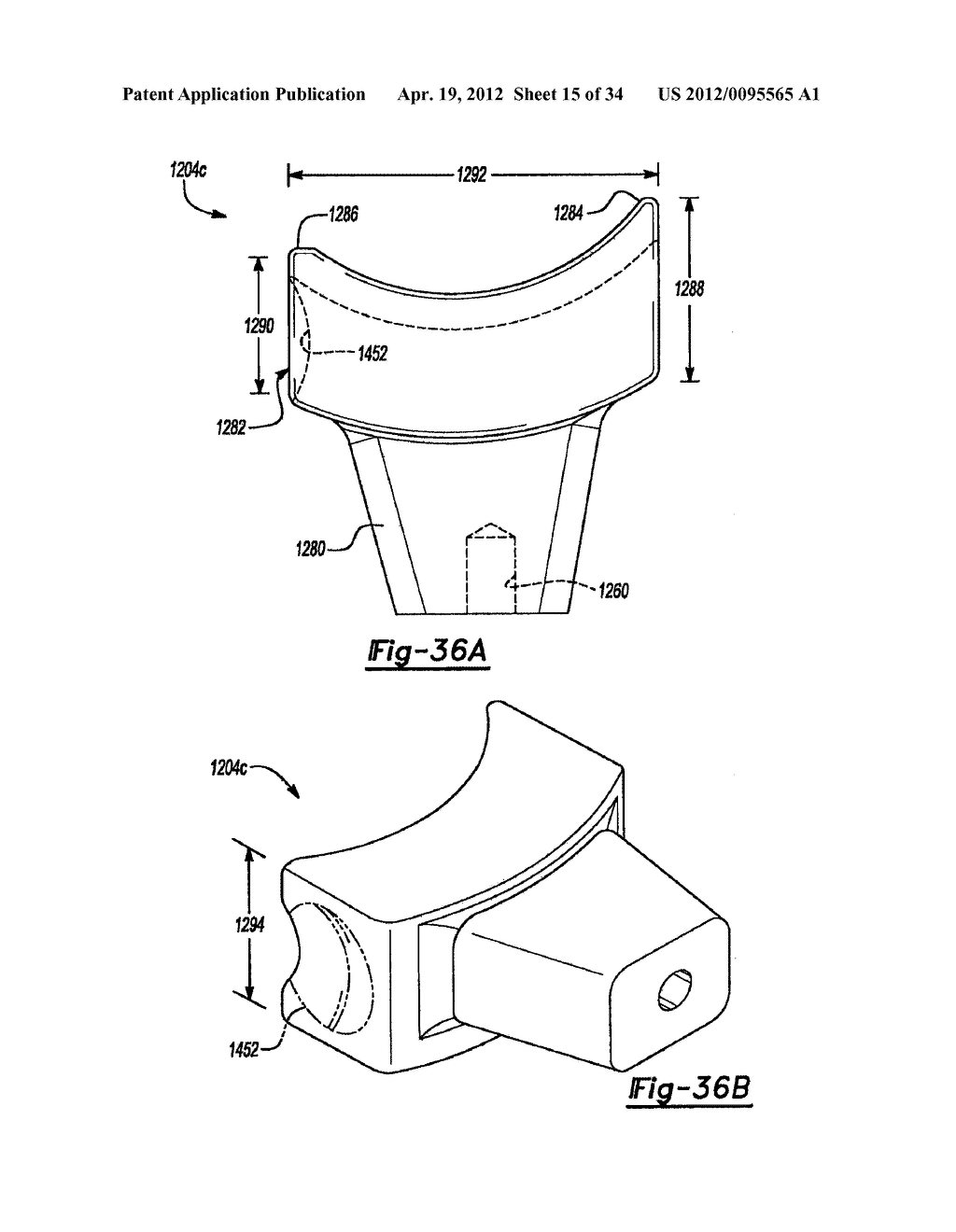 Method And Apparatus For Wrist Arthroplasty - diagram, schematic, and image 16