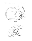 GAS TURBINE ENGINE WITH VARIABLE AREA FAN NOZZLE diagram and image