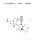 ENDOTRACHEAL TUBE WITH SUBGLOTTIC SECRETION SUCTION AND DETACHABLE SUCTION     CONNECTION LINE diagram and image