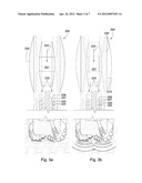 Downhole Mechanism diagram and image