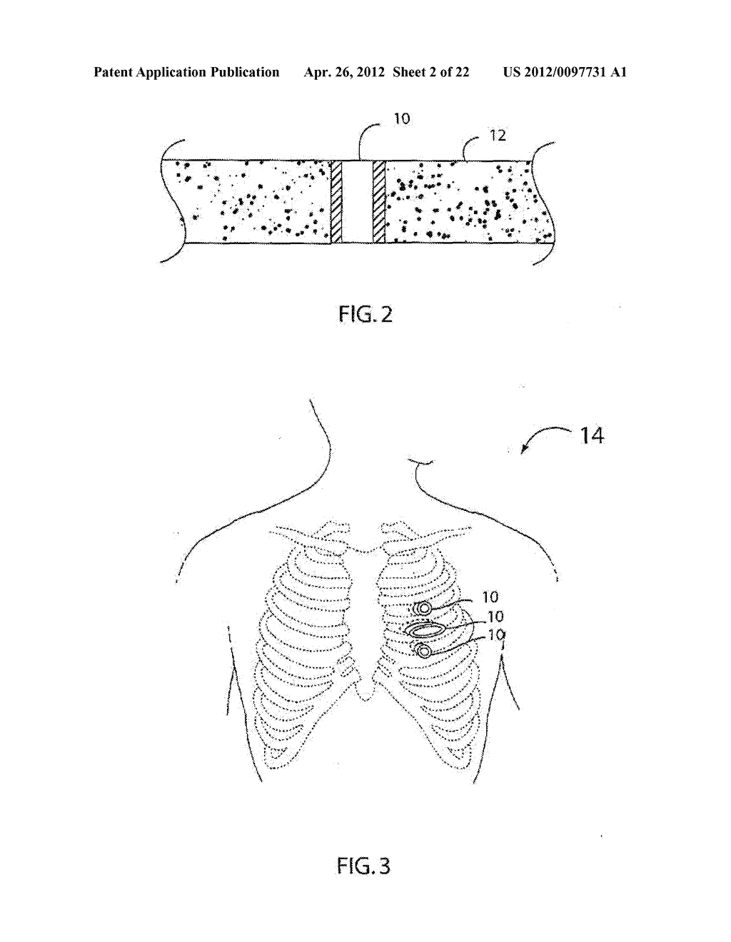 Method of Utilizing A Driverless Surgical Stapler - diagram, schematic, and image 03