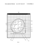 GRAPHICAL USER INTERFACES AND OCCLUSION PREVENTION FOR FISHEYE LENSES WITH     LINE SEGMENT FOCI diagram and image