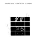 CANCER VACCINE diagram and image