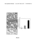 ANTI-CCL25 AND ANTI-CCR9 ANTIBODIES FOR THE PREVENTION AND TREATMENT OF     CANCER AND CANCER CELL MIGRATION diagram and image