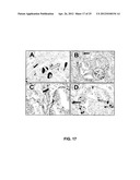 ANTI-CCL25 AND ANTI-CCR9 ANTIBODIES FOR THE PREVENTION AND TREATMENT OF     CANCER AND CANCER CELL MIGRATION diagram and image
