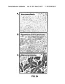 ANTI-CCL25 AND ANTI-CCR9 ANTIBODIES FOR THE PREVENTION AND TREATMENT OF     CANCER AND CANCER CELL MIGRATION diagram and image