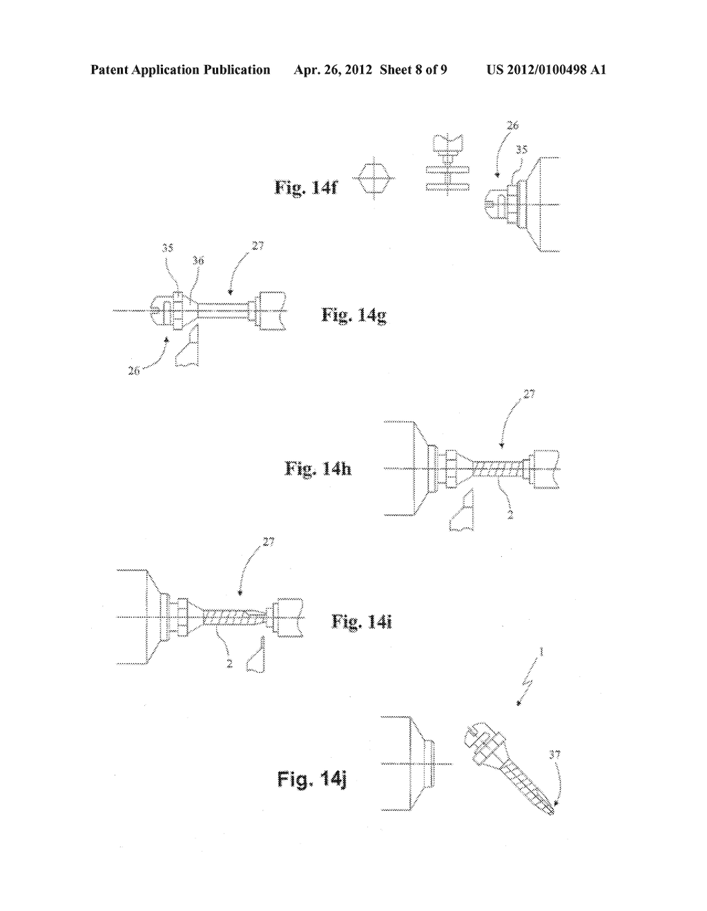 ORTHODONTIC ANCHORING SCREW AND PROCESS FOR MAKING IT - diagram, schematic, and image 09