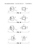 PREFORMED PROVISIONAL CROWNS AND METHODS FOR CONSTRUCTING TEMPORARY DENTAL     CROWNS AND BRIDGES diagram and image