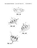 PREFORMED PROVISIONAL CROWNS AND METHODS FOR CONSTRUCTING TEMPORARY DENTAL     CROWNS AND BRIDGES diagram and image