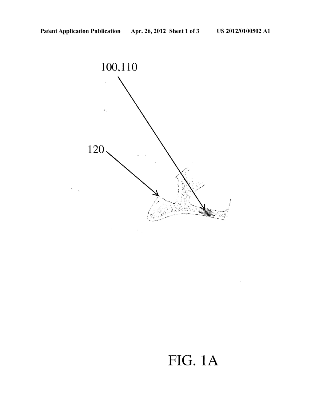 FLATBED DENTAL IMPLANT - diagram, schematic, and image 02