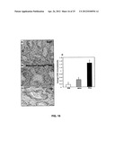 DETECTING CANCER WITH ANTI-CCL25 AND ANTI-CCR9 ANTIBODIES diagram and image