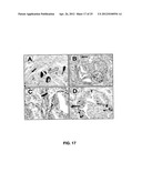 DETECTING CANCER WITH ANTI-CCL25 AND ANTI-CCR9 ANTIBODIES diagram and image