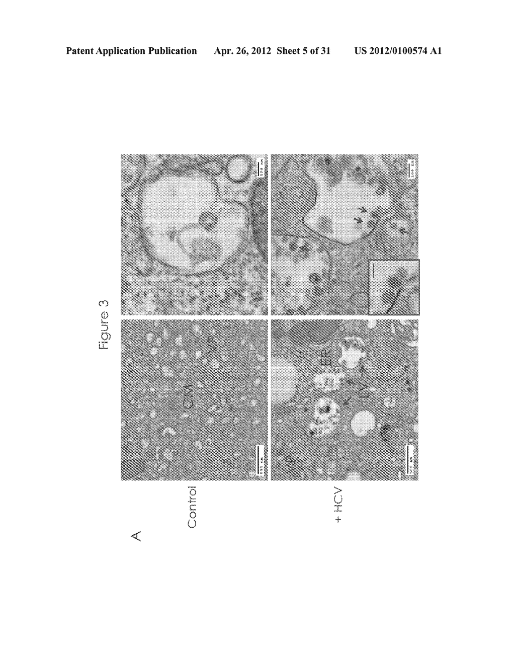 FLAVIVIRUS-BASED SYSTEM FOR PRODUCTION OF HEPATITIS C VIRUS (HCV) - diagram, schematic, and image 06