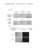 REVASCULARIZATION CELLS DERIVED FROM MONONUCLEAR CELLS, AND METHOD OF     INDUCING DIFFERENTIATION THEREOF diagram and image