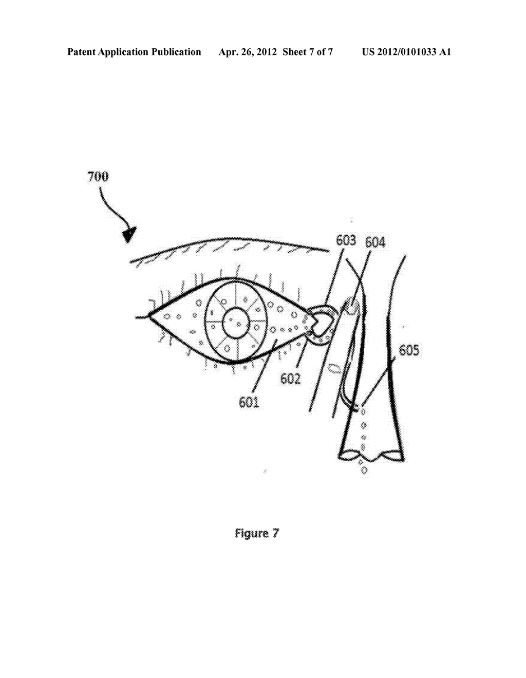 RETINITIS PIGMENTOSA TREATMENT - diagram, schematic, and image 08