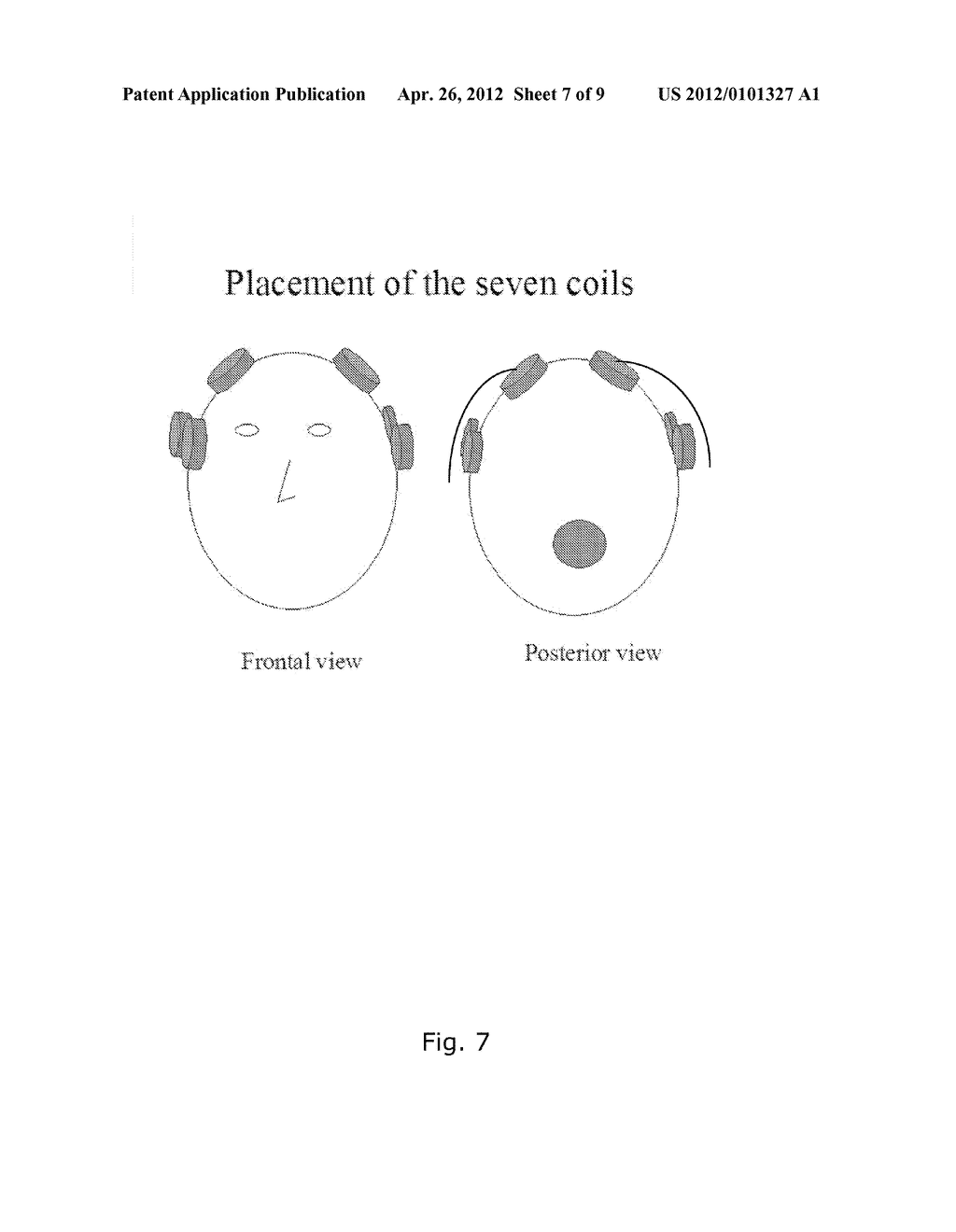 APPARATUS AND METHOD FOR PULSED ELECTRICAL FIELD TREATMENT - diagram, schematic, and image 08