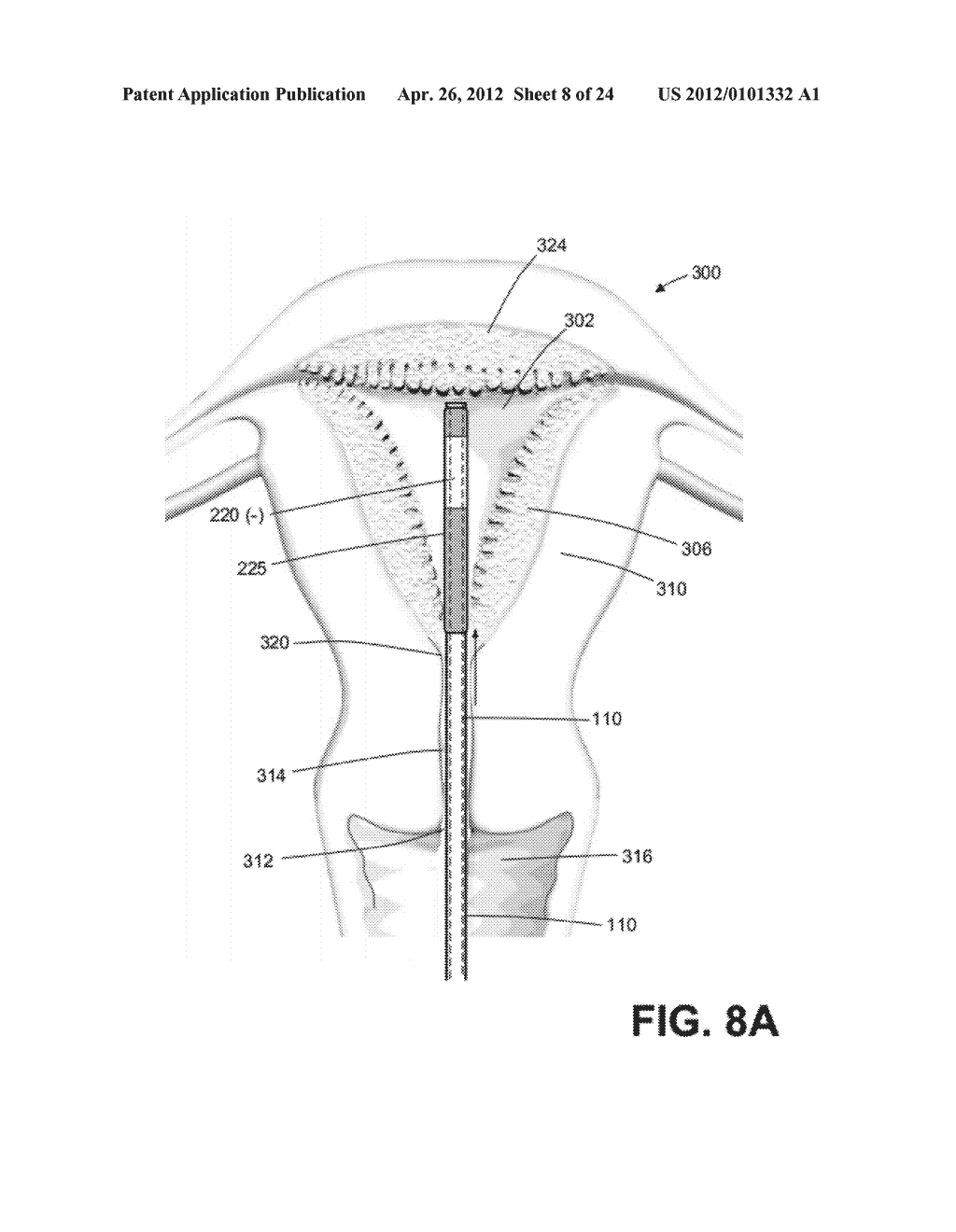 DEVICE FOR ENDOMETRIAL ABLATION HAVING AN EXPANDABLE SEAL FOR A CERVICAL     CANAL - diagram, schematic, and image 09