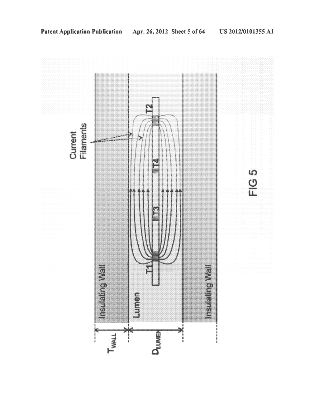 METHODS AND SYSTEMS FOR DETERMINING VASCULAR BODILY LUMEN INFORMATION AND     GUIDING MEDICAL DEVICES - diagram, schematic, and image 06