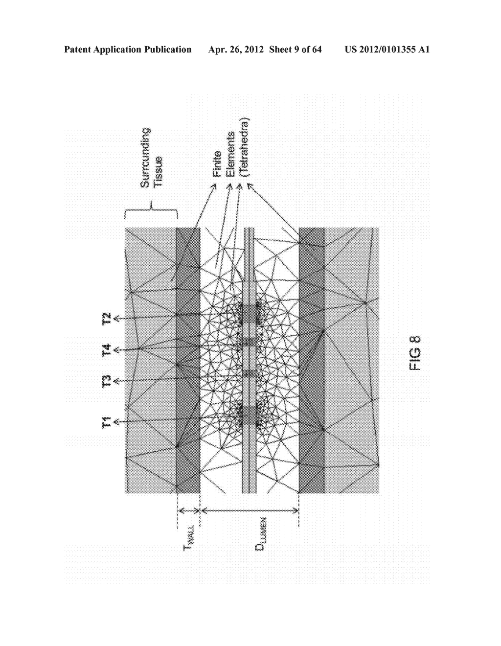 METHODS AND SYSTEMS FOR DETERMINING VASCULAR BODILY LUMEN INFORMATION AND     GUIDING MEDICAL DEVICES - diagram, schematic, and image 10