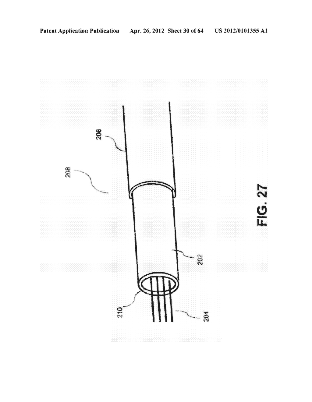 METHODS AND SYSTEMS FOR DETERMINING VASCULAR BODILY LUMEN INFORMATION AND     GUIDING MEDICAL DEVICES - diagram, schematic, and image 31