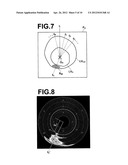 MEDICAL IMAGE DIAGNOSIS ASSISTING APPARATUS, METHOD, AND PROGRAM diagram and image