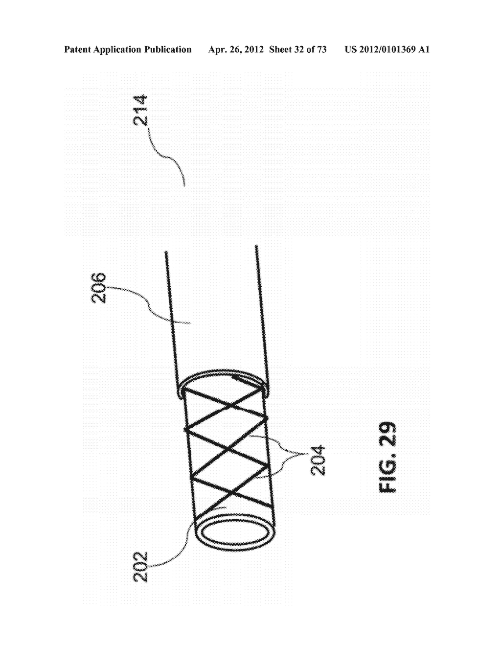 METHODS AND SYSTEMS FOR DETERMINING VASCULAR BODILY LUMEN INFORMATION AND     GUIDING MEDICAL DEVICES - diagram, schematic, and image 33