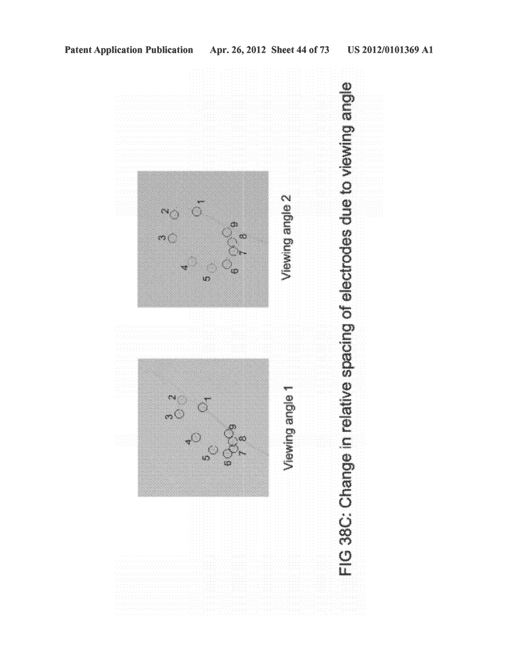 METHODS AND SYSTEMS FOR DETERMINING VASCULAR BODILY LUMEN INFORMATION AND     GUIDING MEDICAL DEVICES - diagram, schematic, and image 45