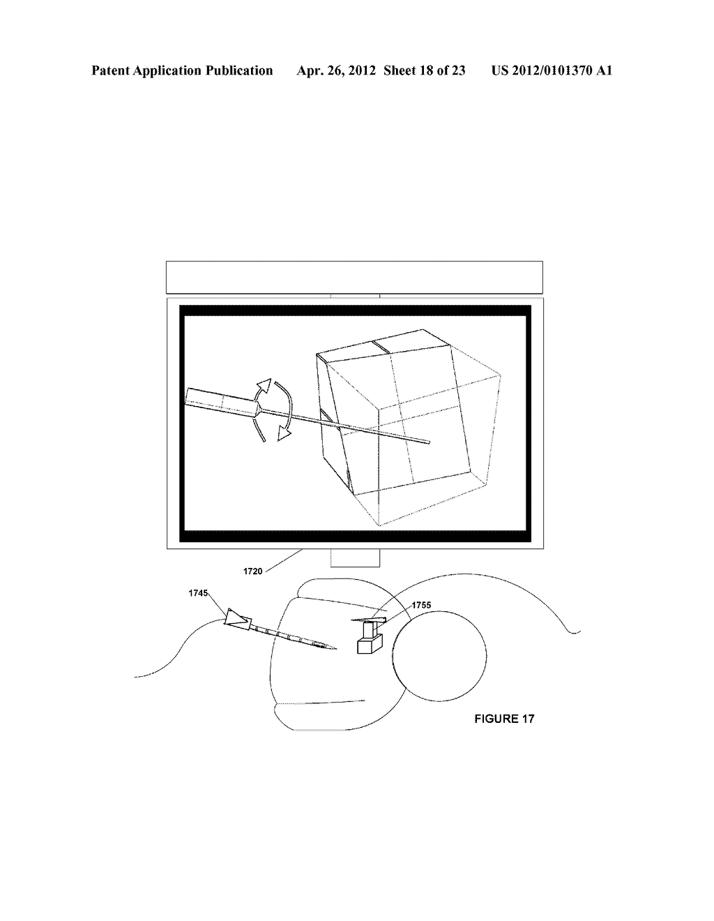 SYSTEMS, METHODS, APPARATUSES, AND COMPUTER-READABLE MEDIA FOR IMAGE     GUIDED SURGERY - diagram, schematic, and image 19