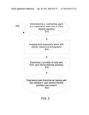 Apparatus and Method For Detecting Amyloid In A Retina in a Diagnosis,     Advancement, and Prognosing Of Alzheimer s disease, traumatic brain     injury, macular degeneration and a plurality of Neurodegenerative     dissorders, and Ocular Diseases diagram and image