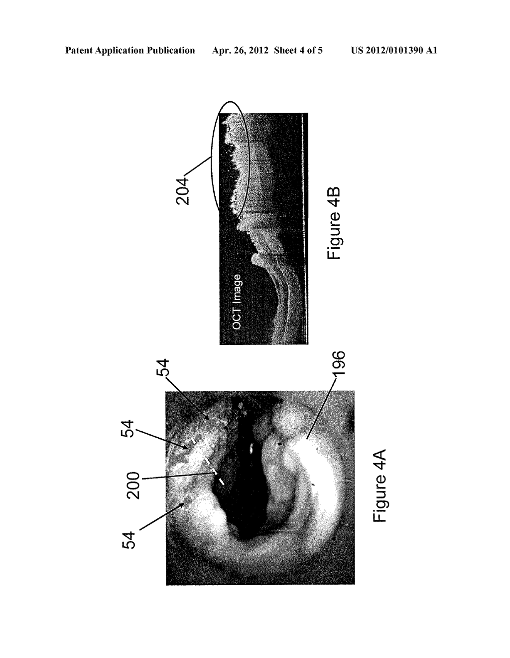 Multi-Modal Imaging for Diagnosis of Early Stage Epithelial Cancers - diagram, schematic, and image 05