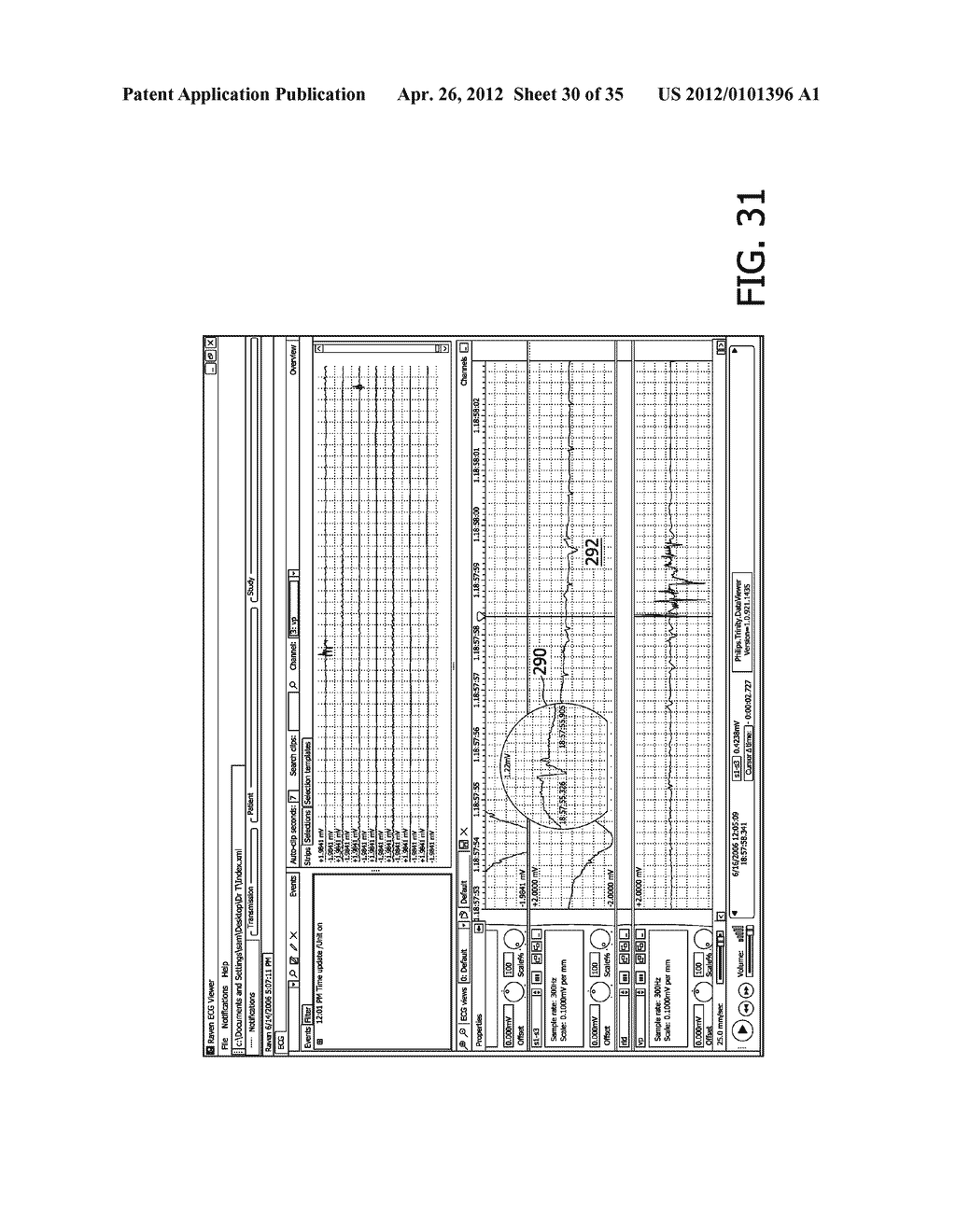 CONTINUOUS OUTPATINET ECG MONITORING SYSTEM - diagram, schematic, and image 31