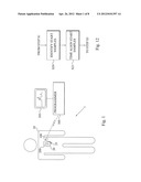 LATE POTENTIAL DETECTION diagram and image