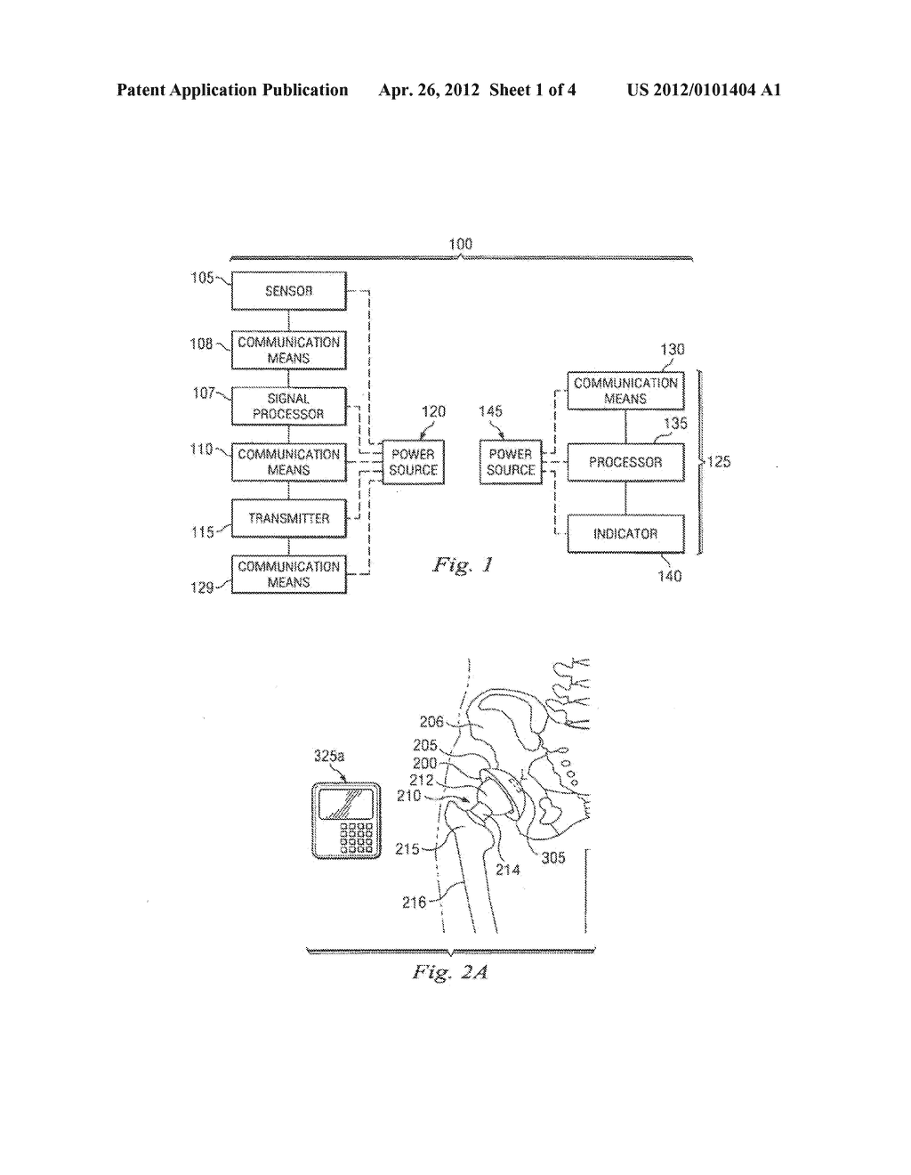 Methods for Detecting Osteolytic Conditions in the Body - diagram, schematic, and image 02