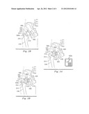 Methods for Detecting Osteolytic Conditions in the Body diagram and image