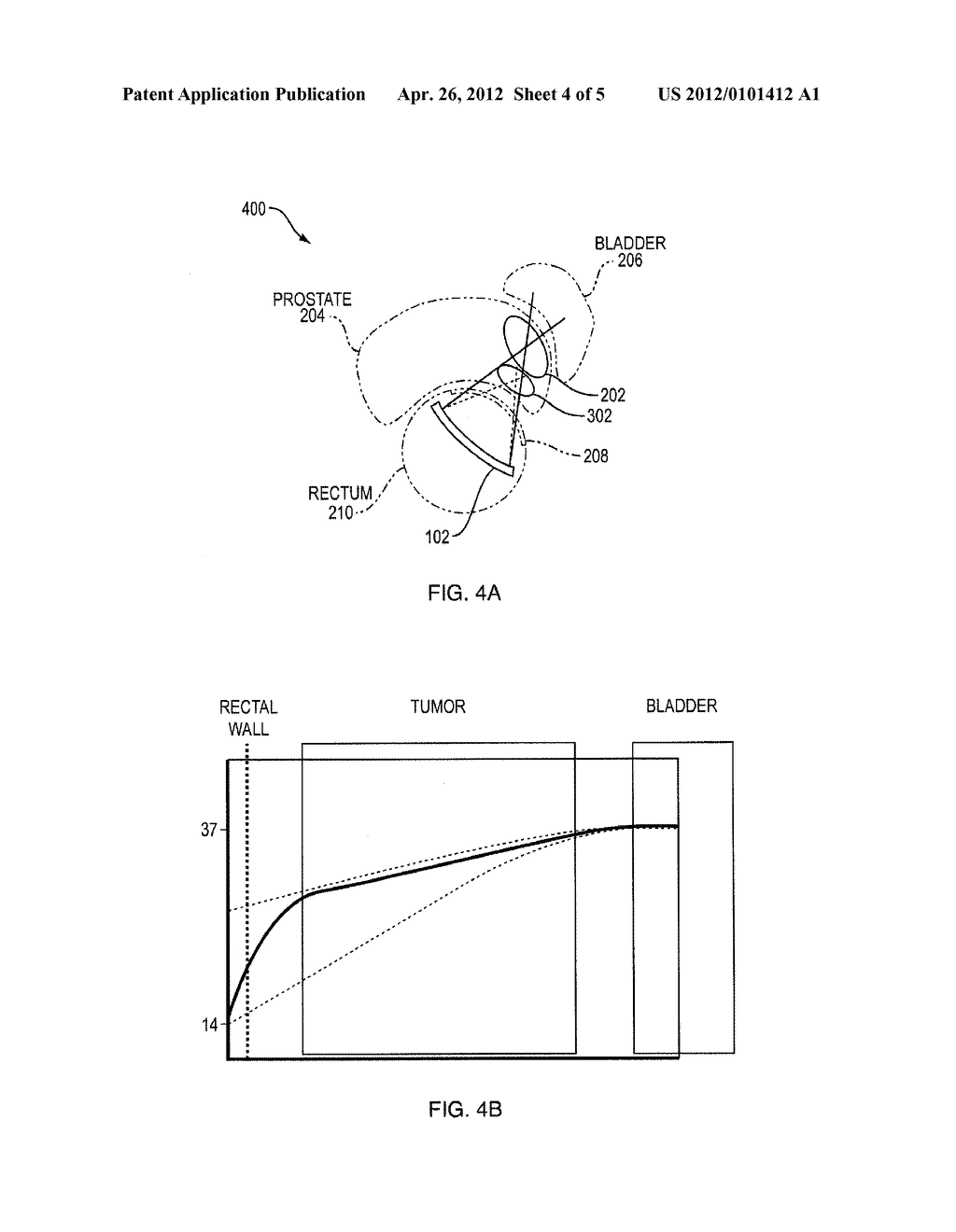 ADAPTIVE ACTIVE COOLING DURING FOCUSED ULTRASOUND TREATMENT - diagram, schematic, and image 05