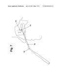 SINUSAL GUIDE CANNULA AND KIT FOR IRRIGATION, SUCTION AND WASHING diagram and image