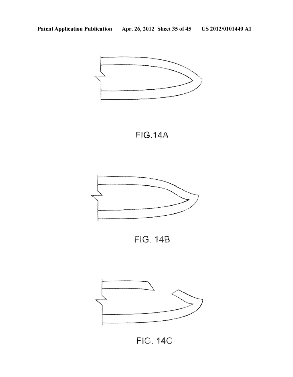 MEDICAL DEVICE INSERTION APPARATUS, SYSTEM AND METHOD - diagram, schematic, and image 36