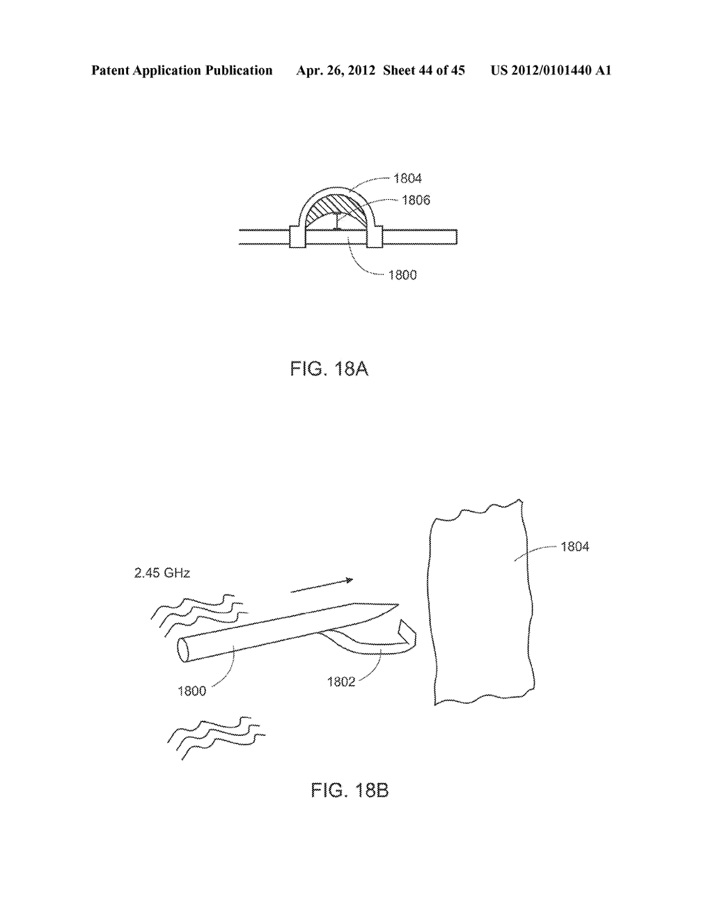 MEDICAL DEVICE INSERTION APPARATUS, SYSTEM AND METHOD - diagram, schematic, and image 45