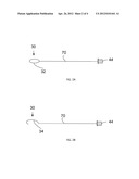 HINGED CATHETER diagram and image