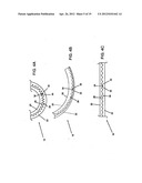 DEFLECTABLE GUIDE diagram and image