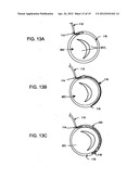 DEFLECTABLE GUIDE diagram and image