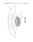 Device for Capsule Retrieval diagram and image