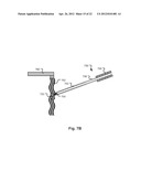 Device for Capsule Retrieval diagram and image