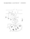 Renal Nerve Ablation Using Conductive Fluid Jet and RF Energy diagram and image